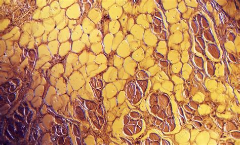 Fat Cells In Muscle Tissue Light Micrograph Stock Image C0490120