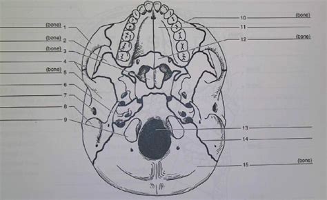 Quia Anatomy Inferior Skull Identification
