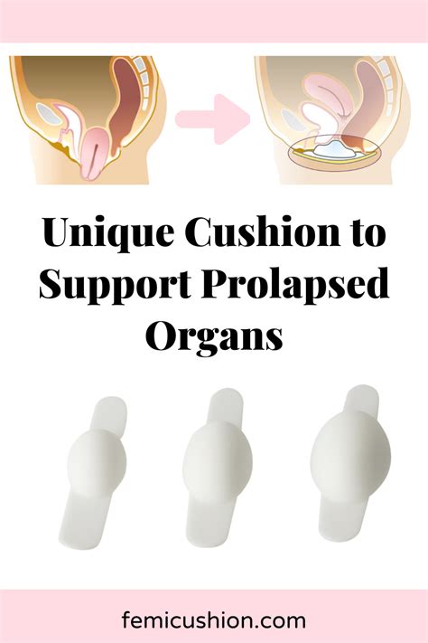 Prolapse Exercises Pelvic Organ Prolapse Pelvic Floor Exercises Prolapsed Uterus Natural