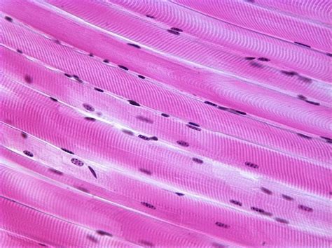 Each fiber appears striated under a microscope (i.e., having dark. Striated skeletal muscle tissue ~ Free Lecture Notes and ...