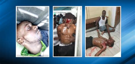 Shotguns launch shot in a string. Bank robbery suspect succumbs to gun shot wounds; Best ...