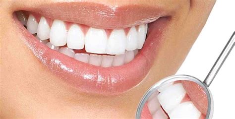 Čišćenje Zubnog Kamenca Pjeskarenje Poliranje Zubi I Prvi Pregled Za