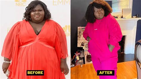 Gabourey Sidibe Weight Loss 2023 Gabbys Surgery Diet And Ozempic Use Details