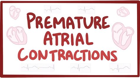 Premature Atrial Contraction Osmosis