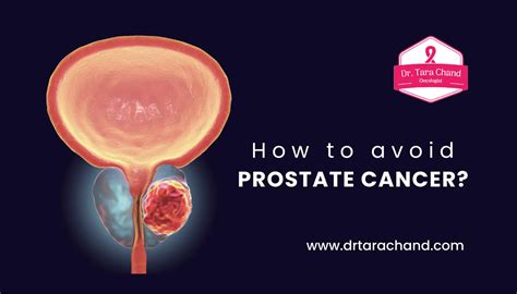 How To Avoid Prostate Cancer Dr Tarachand