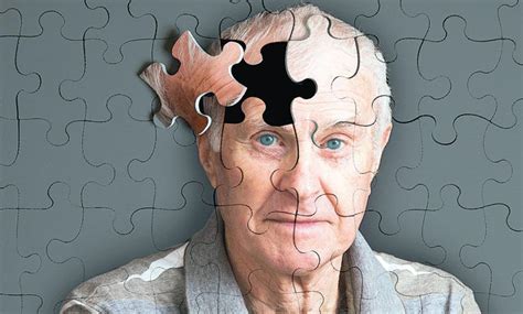 ¿qué Es El Alzheimer Y Cuáles Son Los Síntomas De Esta Enfermedad