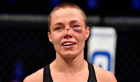UFC S Rose Namajunas Suffers Horror Face Injury But STILL Wins Brutal
