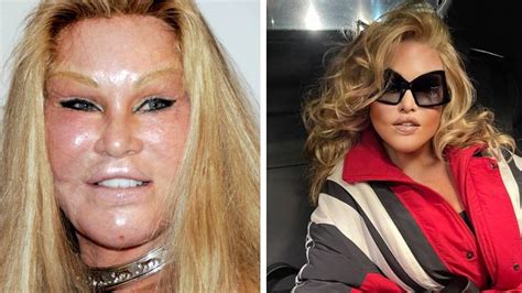 Jocelyn Wildenstein Shares Throwback Photo To Prove Shes Never Had