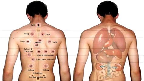 Rcts on cupping therapy for various diseases were included. 10 Amazing Benefits Of Cupping Therapy | Cure AIDS, Cancer ...