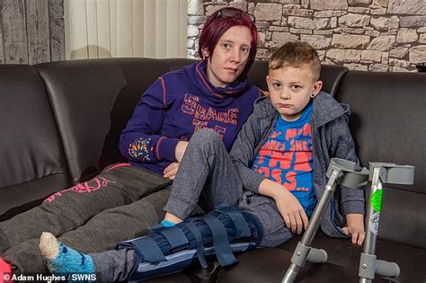 Halesowen Mother Claims Teachers Forced Her Son To Do Pe After He Broke