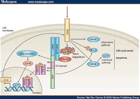 The Anaplastic Lymphoma Kinase In The Pathogenesis Of Cancer