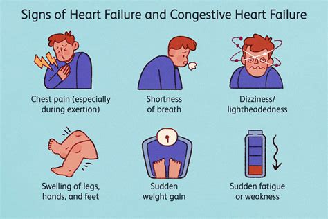 Congestive Heart Failure Types Symptoms Causes Treatment
