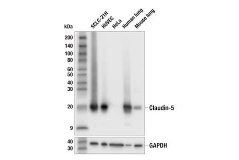 Claudin 5 E5D9Y Rabbit MAb Cell Signaling Technology