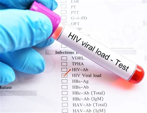What Is Viral Load