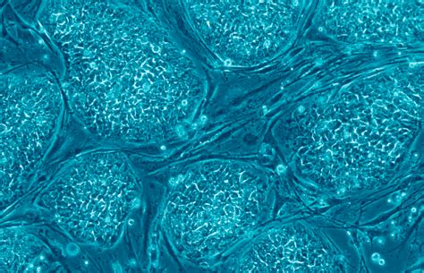 An Immoral Proposal A Case Against Embryonic Stem Cell Research Part