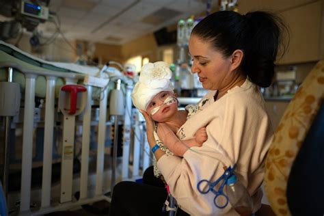 Rare Conjoined Twins Successfully Separated ‘its All In Gods Hands