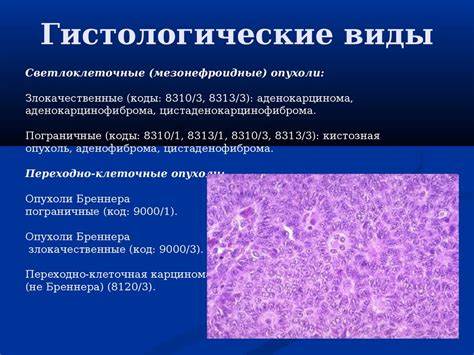 Рак яичников диета Рак яичников - презентация онлайн Рак яичников - презентация онлайн Рак яичников диета