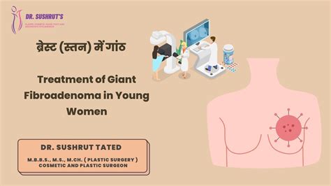 Treatment Of Giant Fibroadenoma In Young Women ब्रेस्ट स्तन में