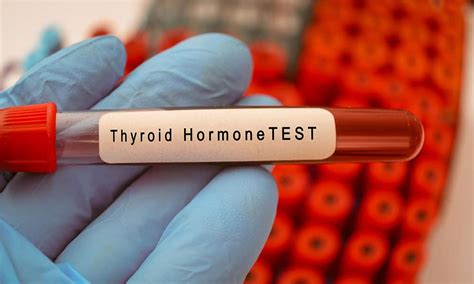 Thyroid Rfa Frequently Asked Questions