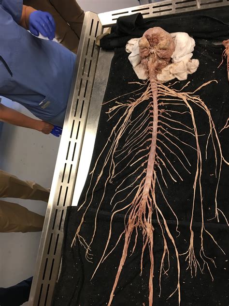 The nervous system is a complex network of neurons and cells that carry messages to and from the brain and spinal cord to various parts of the body. neuropathology blog: Remarkable en bloc dissection of ...