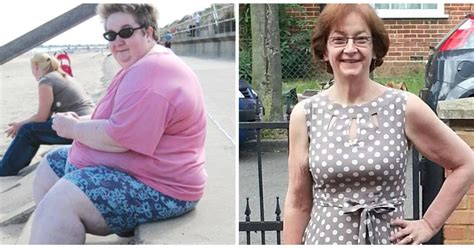 Midwife Loses The Weight Of 24 Babies MyLondon