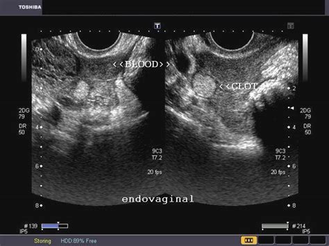 A Gallery of High-Resolution, Ultrasound, Color Doppler ...