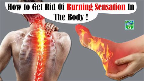 How To Get Rid Of Burning Sensation In The Body Youtube