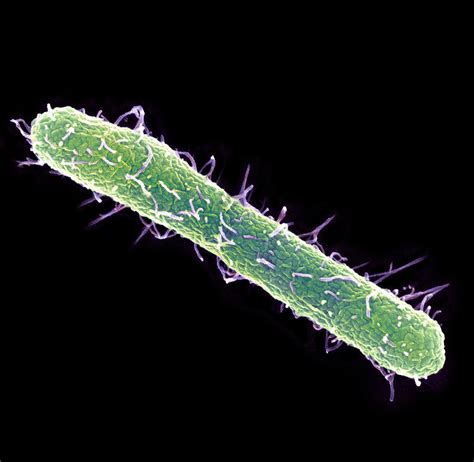 Paratyphoid fever is caused by s. BACTERIOLOGIA: LAS ENTEROBACTERIAS