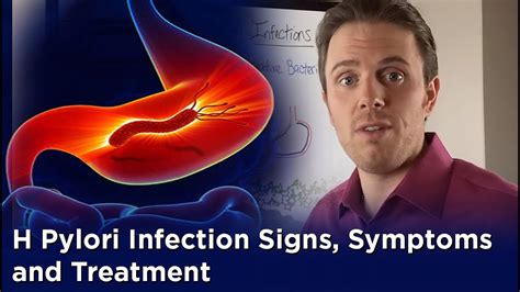 H Pylori Infection Signs Symptoms And Treatment