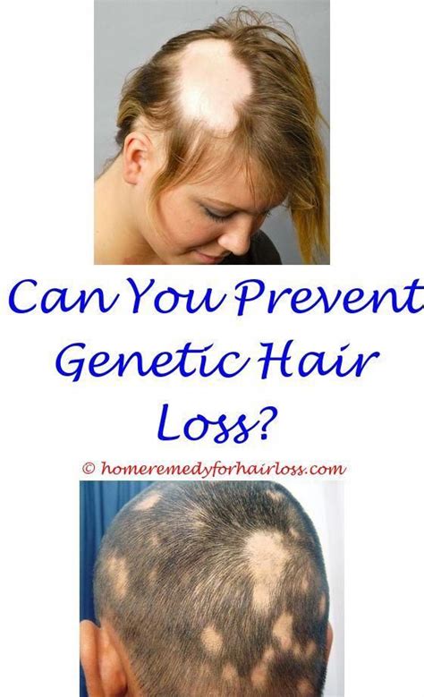 If hair fall is alarming, it is advisable to consult a good dermatologist for hair fall treatments. what causes excessive sweating and hair loss - marine ...