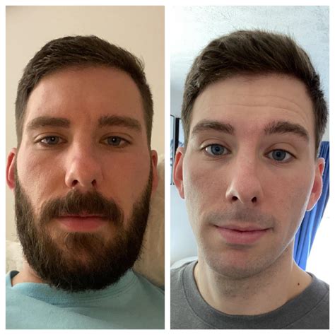 Beard Vs No Beard Rbeards