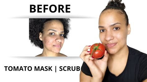 TOMATO JUICE FOR FACE HOW TO GET FAIR SKIN REMOVE DARK SPOTS AND