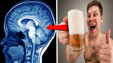 Qu Le Pasa Exactamente Al Cerebro Cu Ndo Tomamos Alcohol
