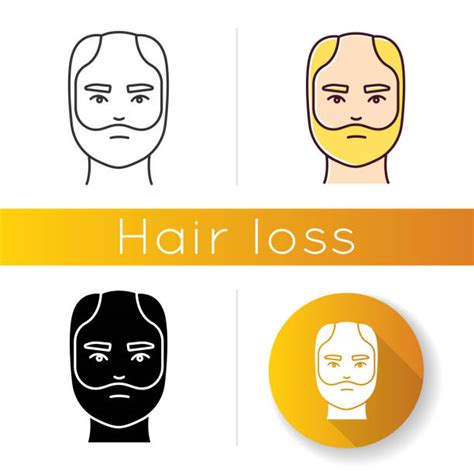 Man With Thinning Hair Illustrations Royalty Free Vector Graphics And Clip Art Istock