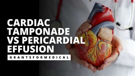 Cardiac Tamponade Vs Pericardial Effusion