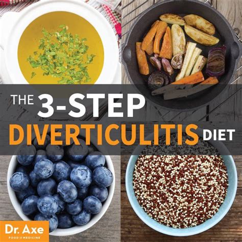 3-Step Diverticulitis Diet & Treatment Plan — Info You ...