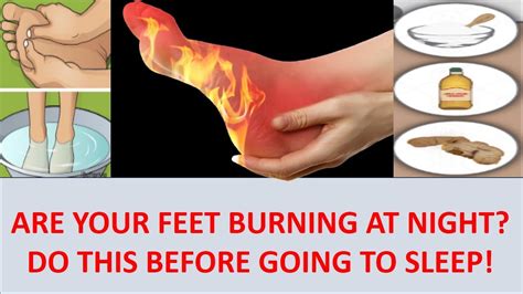 Are Your Feet Burning At Night Do This Before Going To Sleep Youtube