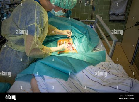 Surgical Sutures High Resolution Stock Photography And Images Alamy