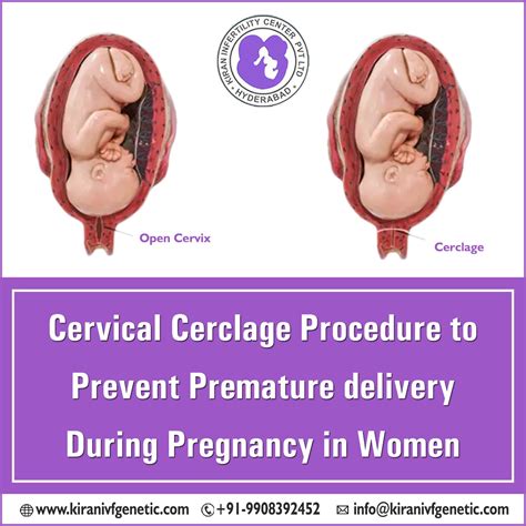 Cervical Cerclage Procedure To Prevent Premature Delivery Kiran Ivf Genetic Surrogacy India