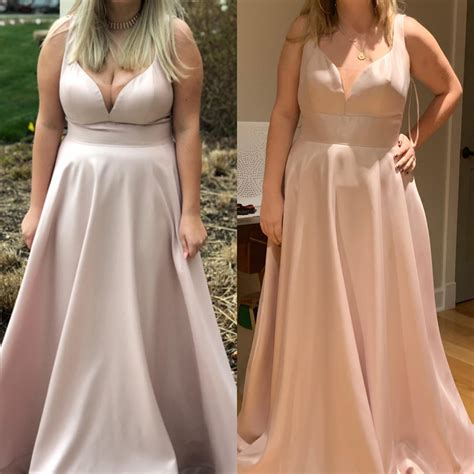 Me In My Prom Dress Senior Year Vs Now Post Op This Is