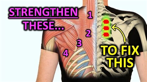 Strengthen These Muscles To Fix Rhomboid Pain Youtube