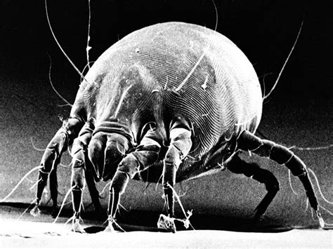 Atopic Dermatitis Treatment Could Dust Mite Extract Help