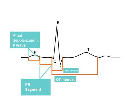 Basic Electrocardiography Interpretation
