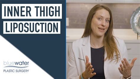 Liposuction Inner Thigh Results Liposuction 360 Raleigh North