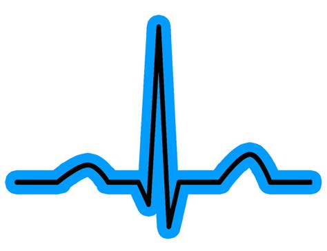 Heart Rhythm Guide Heart Rhythm Heart Rate And Pacemaker Information