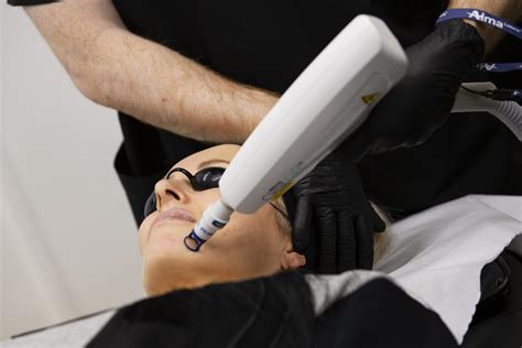 Clearlift Laser By Alma Lasers The Esho Clinic