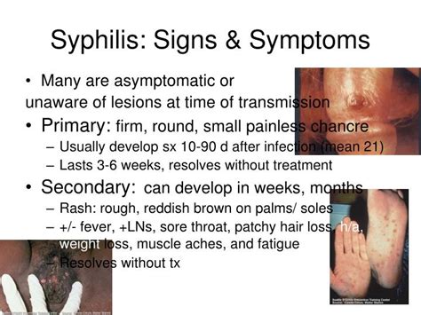 Syphilis Symptoms In Men Sign And Symptoms Of Syphilis In Men And