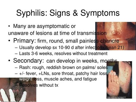 Learn how to recognize some of the symptoms and how they symptoms for the first stage normally appear 10 days to 3 months after you're exposed to syphilis. PPT - STD Overview PowerPoint Presentation - ID:846253