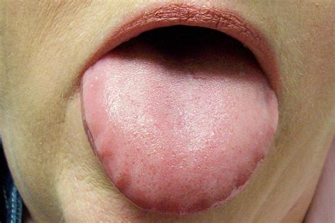 Berry Diaries: Enough about Poo, What your Tongue says about You