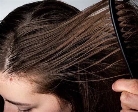Have Oily Hair In Summer Try These 10 Effective Home Remedies Herzindagi